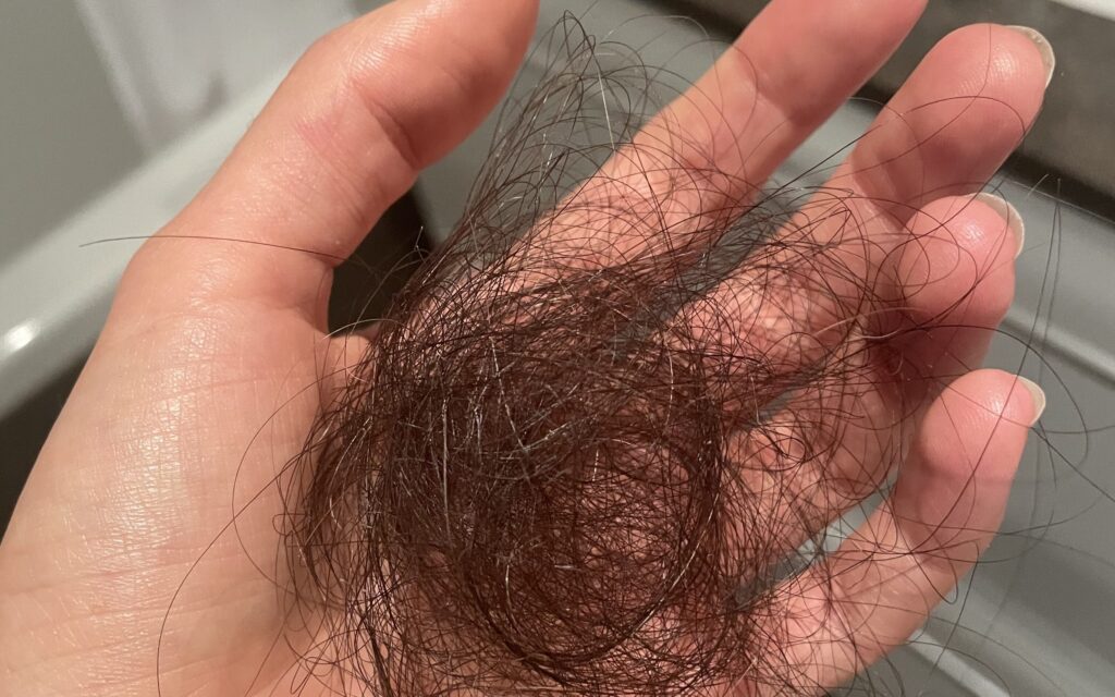 An image of a large wad of hair representing hair loss